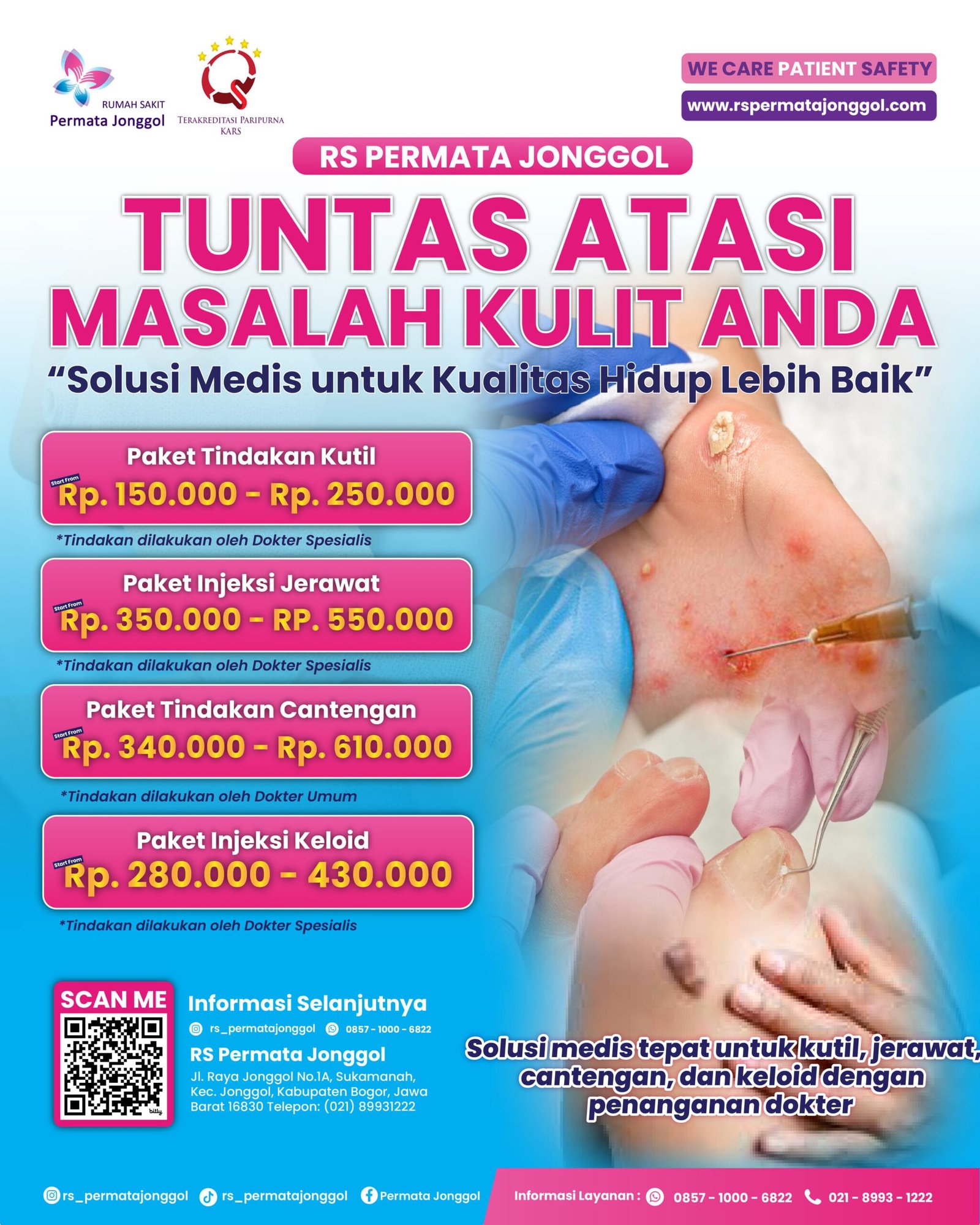 PAKET TINDAKAN KUTIL CANTENGAN JERAWAT KELOID-01-01