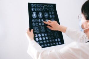 KENALI DOKTER SPESIALIS BEDAH SARAF: PENYAKIT APA SAJA YANG BISA DITANGANI?
